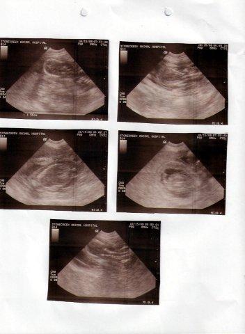 attachment_p_54022_0_ultrasound101508smaller.jpg